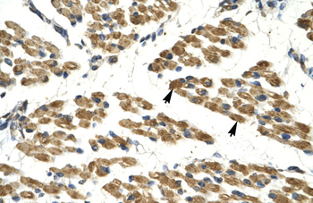 HHEX Rabbit Polyclonal Antibody