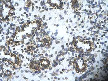 HHEX Rabbit Polyclonal Antibody