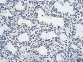 HHEX Rabbit Polyclonal Antibody