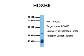 HOXB5 Rabbit Polyclonal Antibody