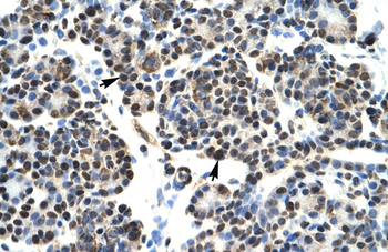 HOXB5 Rabbit Polyclonal Antibody
