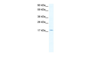 PQBP1 Rabbit Polyclonal Antibody