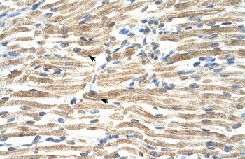YAF2 Rabbit Polyclonal Antibody