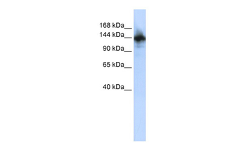 RBM6 Rabbit Polyclonal Antibody