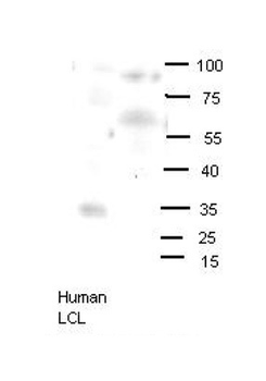 OLIG2 Rabbit Polyclonal Antibody