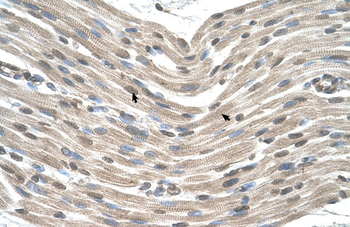 CDX4 Rabbit Polyclonal Antibody