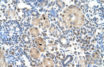 ZNF274 Rabbit Polyclonal Antibody