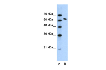 SUPT16H Rabbit Polyclonal Antibody