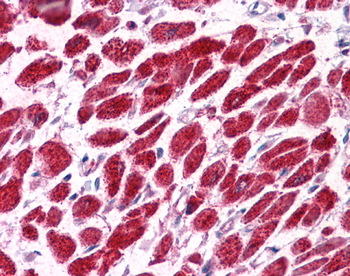 EAP30 Rabbit Polyclonal Antibody