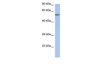 ZNF513 Rabbit Polyclonal Antibody