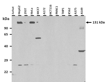 AEBP1 Rabbit Polyclonal Antibody
