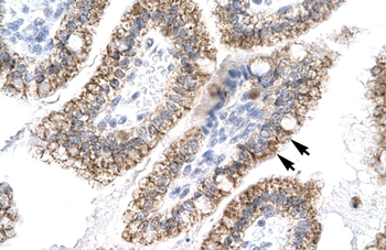 AEBP1 Rabbit Polyclonal Antibody