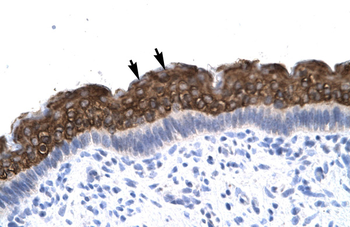 AEBP1 Rabbit Polyclonal Antibody
