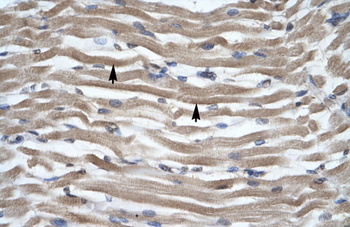 DLX2 Rabbit Polyclonal Antibody