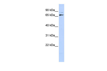 DLX4 Rabbit Polyclonal Antibody