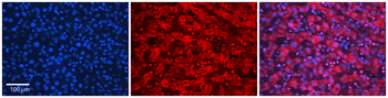 SLC26A3 Rabbit Polyclonal Antibody