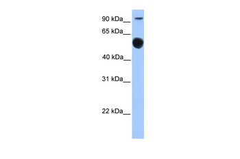 EBF1 Rabbit Polyclonal Antibody
