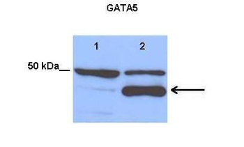 GATA5 Rabbit Polyclonal Antibody