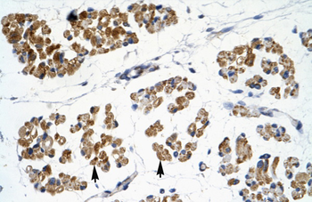 EMX2 Rabbit Polyclonal Antibody