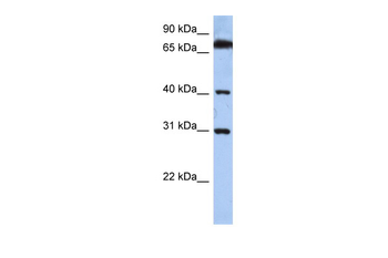DHRSX Rabbit Polyclonal Antibody