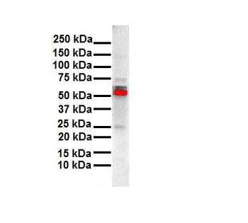 ESR2 Rabbit Polyclonal Antibody