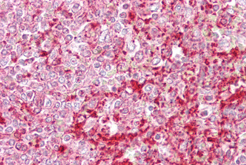 ETV5 Rabbit Polyclonal Antibody