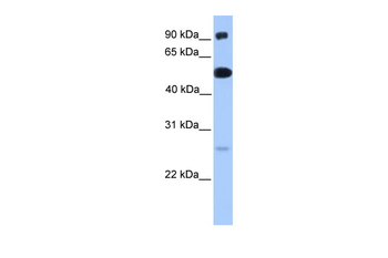 ETV5 Rabbit Polyclonal Antibody