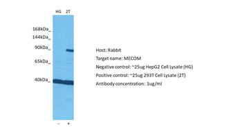 EVI1 Rabbit Polyclonal Antibody