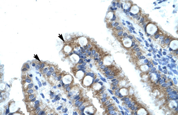 EVI1 Rabbit Polyclonal Antibody