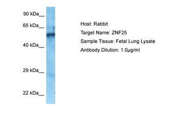 ZNF25 Rabbit Polyclonal Antibody