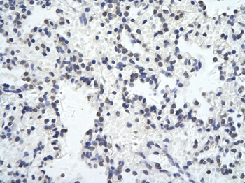 ZNF652 Rabbit Polyclonal Antibody