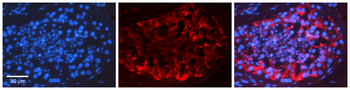 RAD51 Rabbit Polyclonal Antibody