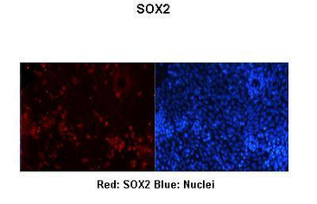SOX2 Rabbit Polyclonal Antibody