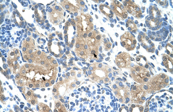 TLR6 Rabbit Polyclonal Antibody