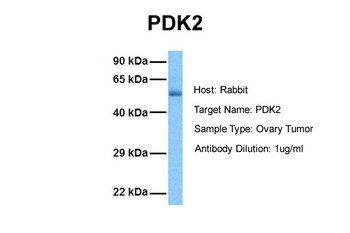 PDK2 Rabbit Polyclonal Antibody