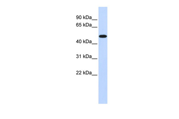 PDK2 Rabbit Polyclonal Antibody