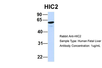 HIC2 Rabbit Polyclonal Antibody