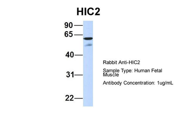 HIC2 Rabbit Polyclonal Antibody