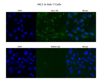 HIC2 Rabbit Polyclonal Antibody