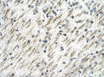 SSBP2 Rabbit Polyclonal Antibody