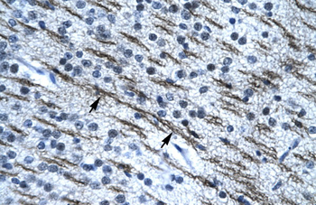 SSBP2 Rabbit Polyclonal Antibody