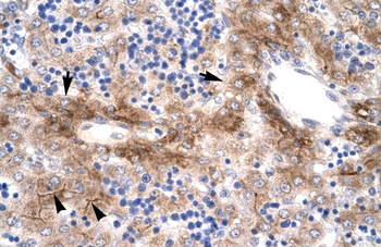 NR5A1 Rabbit Polyclonal Antibody