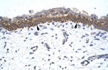 ZNF385 Rabbit Polyclonal Antibody