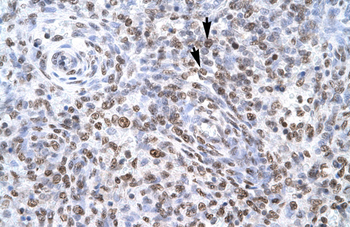 ZNF500 Rabbit Polyclonal Antibody