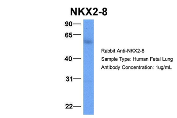 NKX2-8 Rabbit Polyclonal Antibody
