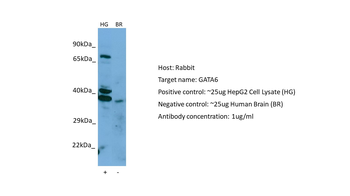GATA6 Rabbit Polyclonal Antibody