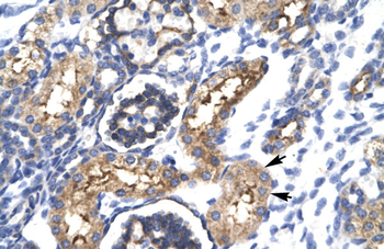 EHF Rabbit Polyclonal Antibody