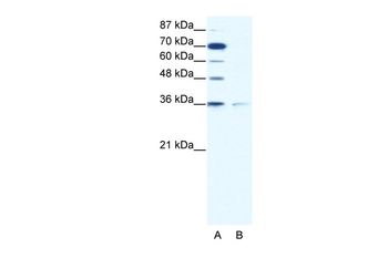 ZNF326 Rabbit Polyclonal Antibody