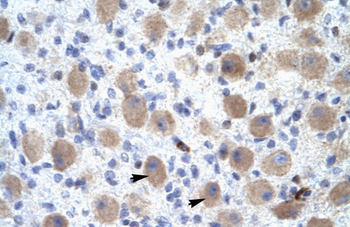 OR13C9 Rabbit Polyclonal Antibody