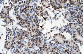 GTF2I Rabbit Polyclonal Antibody